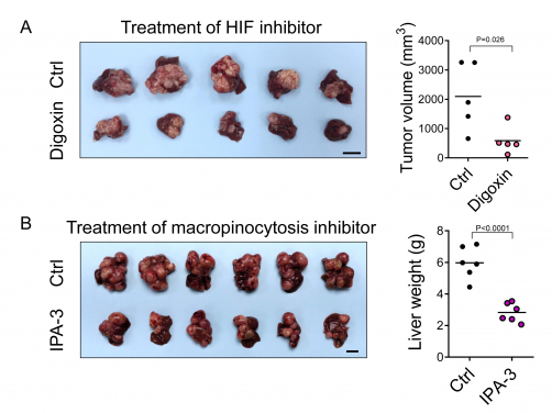 HKUMed discovers a new metabolic route for liver cancer  paving the way for new therapeutic opportunities 