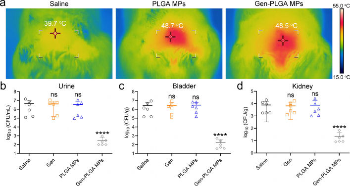 Treatment efficacy：Urinary tract infection: a) Thermal images indicating the skin temperature over the bladder after injection with saline, PLGA microparticles (MPs), and gentamicin-loaded PLGA MPs (Gen-PLGA MPs), and microwave hyperthermal (MWH) irradiation for 10 minutes. b–d) MDR E. coli bacterial burden in b) urine, c) the bladders, and d) the kidneys after different interventions. It’s obvious that the group of gentamicin-loaded PLGA MPs after MWH can significantly reduce the bacterial load as compared with other groups.
 