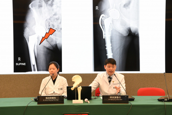 HKUMed study demonstrates that robotic total hip replacement has a lower reoperation rate than the conventional technique. The research team members include Dr Henry Fu Chun-him (right) and Dr Amy Cheung Yim-ling.
 